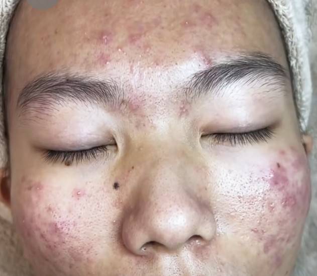 蒞百加美姸ㄧ房老師｜南港做臉｜清粉刺｜美容｜臉部保養｜SPA｜霧眉 店內環境照片 5