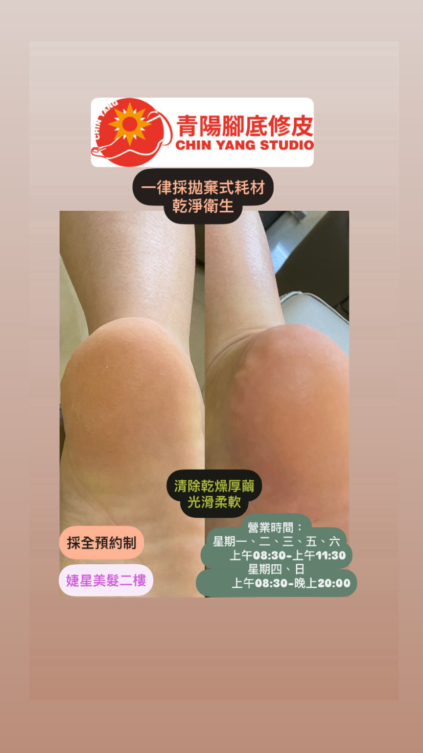 青陽腳底修皮｜修凍甲｜修腳皮｜腳底按摩｜經絡指壓｜ 店家封面照片