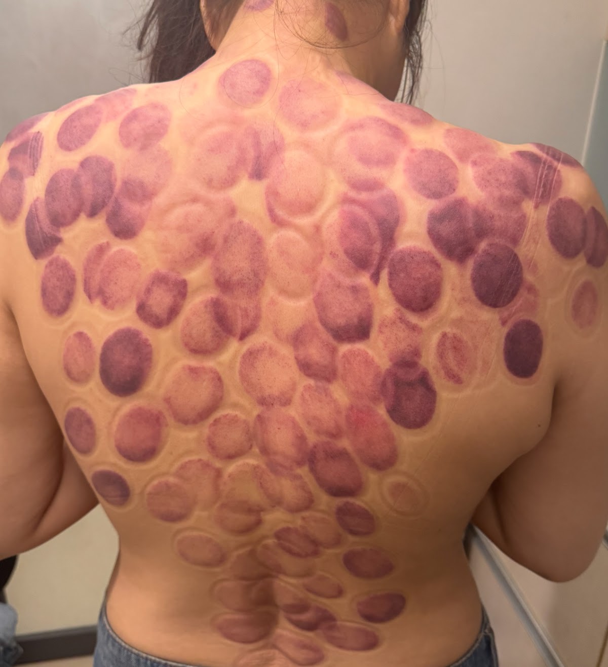 彩珍經絡調理/氣結推拿/拔罐/刮痧/撥筋 店內環境照片 5